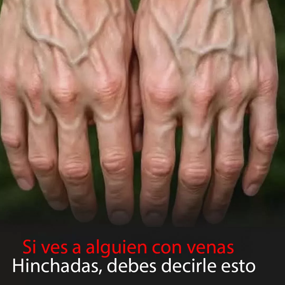 Portada2